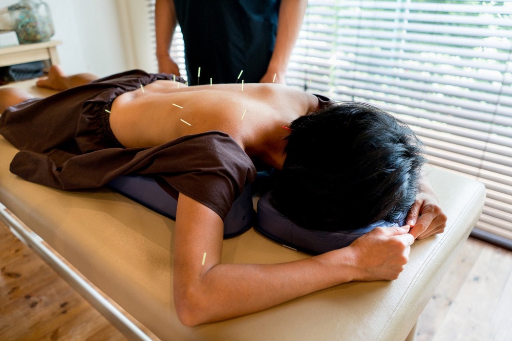 Signs You Need to See an Acupuncturist
