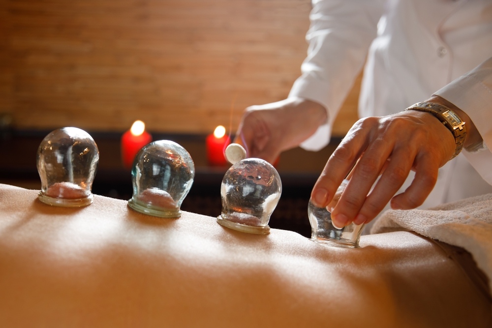 What Does Cupping Get Rid of?
