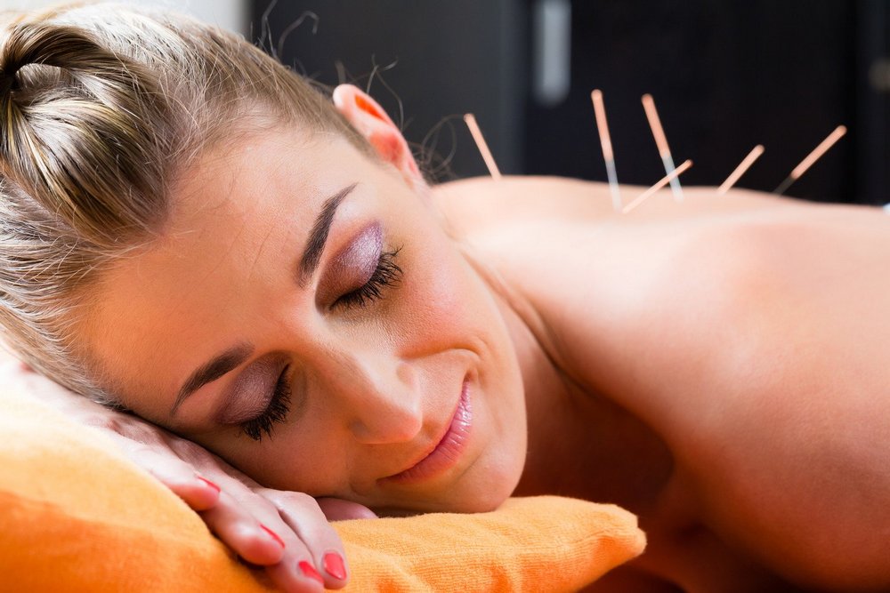 What is the Main Benefit of Acupuncture