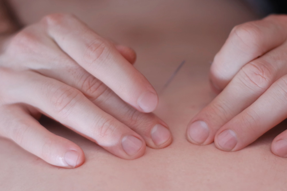 How Acupuncture Can Help You Achieve Your Health Goals this 2025