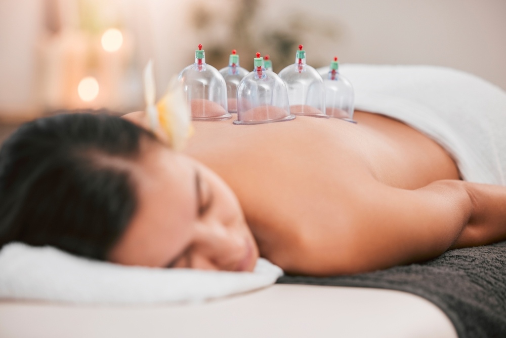 Cupping Therapy for Better Sleep: Relieving Insomnia and Stress